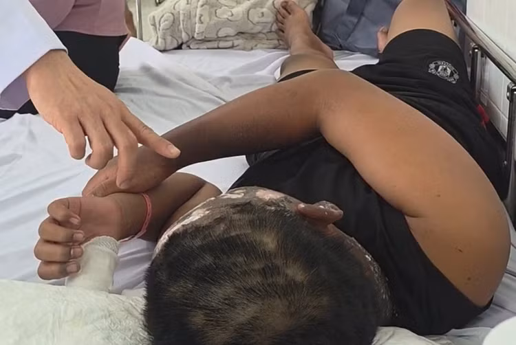 Tai nạn pháo nổ thường xảy ra vào dịp Tết là nguyên nhân khiến nhiều trẻ em rơi vào cảnh tàn phế. (Ảnh minh hoạ)/LĐTĐ