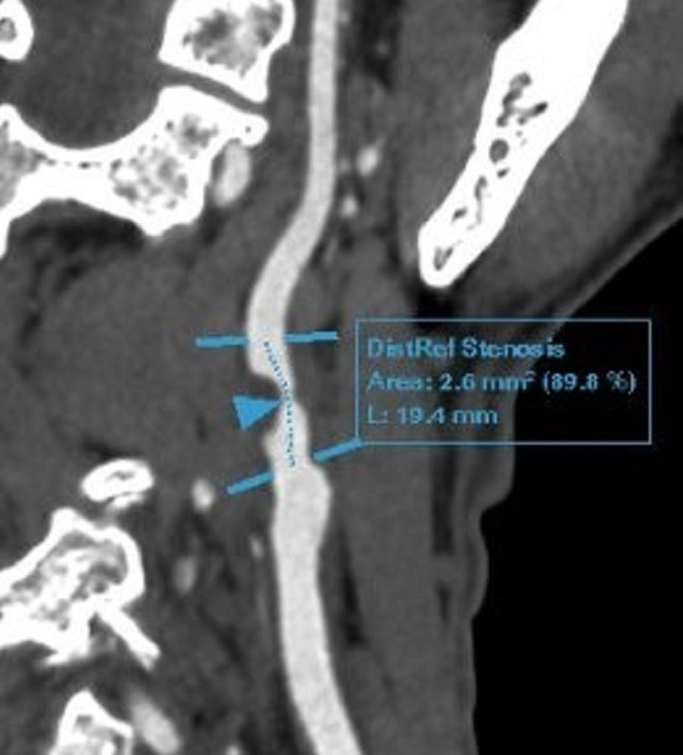 Phim chụp tổn thương của bệnh nhân. Ảnh CAND