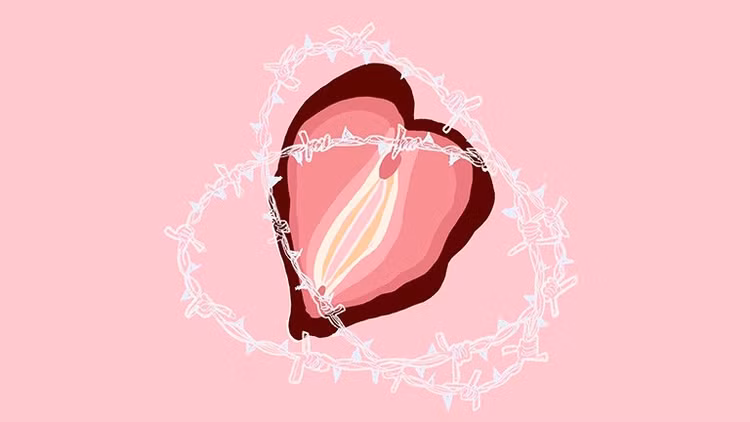 Hội chứng co thắt âm đạo (Vaginismus) là một dạng rối loạn chức năng tình dục xảy ra ở bộ phận âm đạo/Ảnh minh hoạ/Nguồn Internet