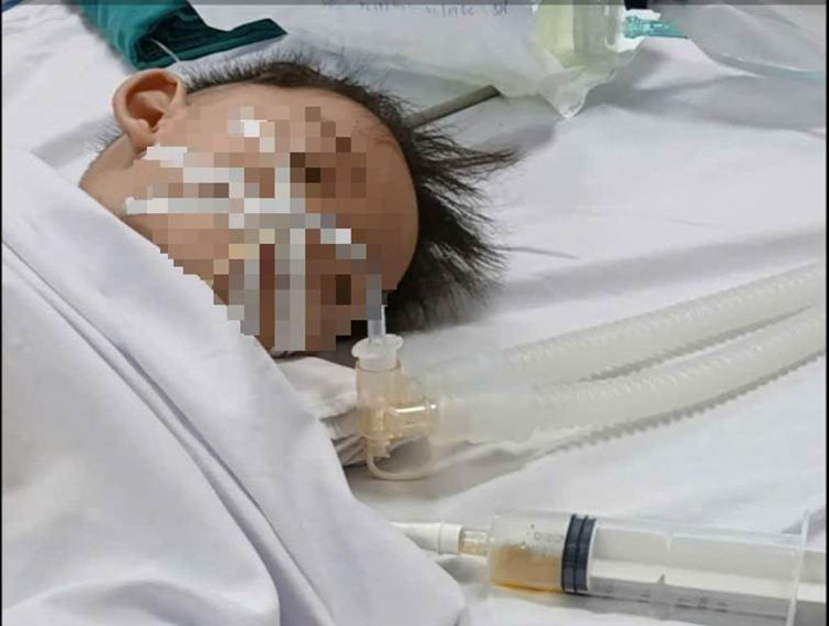 Hình ảnh bé trai 18 tháng tuổi bị đuối nước được các bác sĩ cứu sống. Ảnh: BVCC.