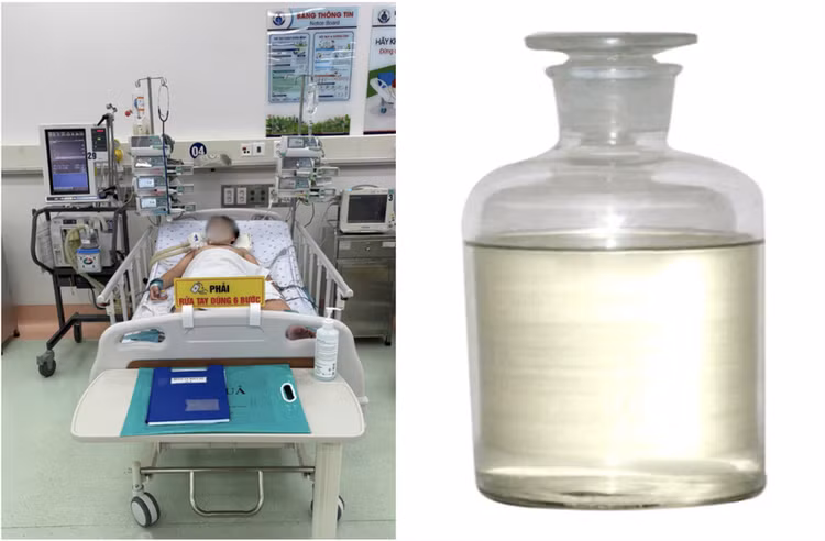 Bé trai khoẻ mạnh đột ngột hôn mê, suy hô hấp do hít phải hóa chất người cha mua dùng để hàn nhựa. Ảnh: BVCC