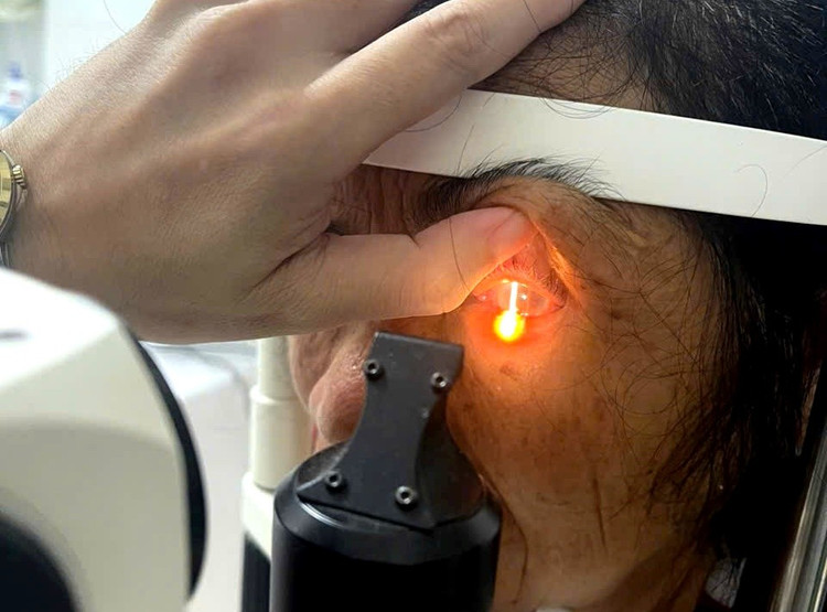 Sau 4 ngày điều trị, mắt phải đạt 5/10 và mắt trái 6/10. Ảnh Sở Y tế Hà Tĩnh