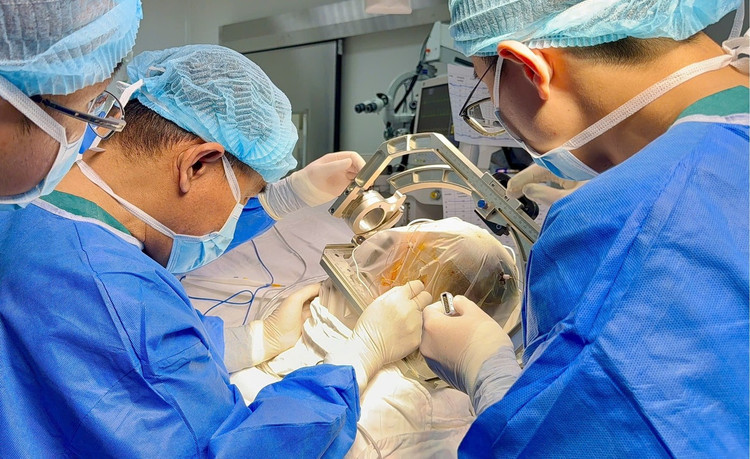 Sau khi đặt điện cực não sâu, phẫu thuật loại bỏ ổ sinh động kinh, bệnh nhân đang bình phục tốt. Ảnh tienphong.vn
