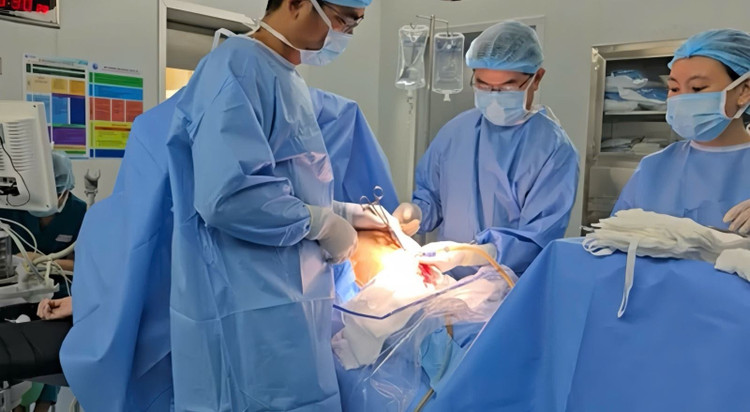 Sau 240 phút căng thẳng, khối u nặng hơn 20 kg đã được cắt bỏ hoàn toàn. Ảnh: BSCC