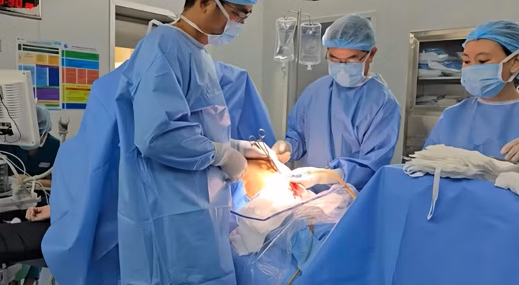 Sau 240 phút căng thẳng, khối u nặng hơn 20 kg đã được cắt bỏ hoàn toàn. Ảnh: BSCC