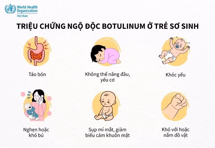Triệu chứng ngộ độc botulinum ở trẻ sơ sinh. Nguồn: WHO.