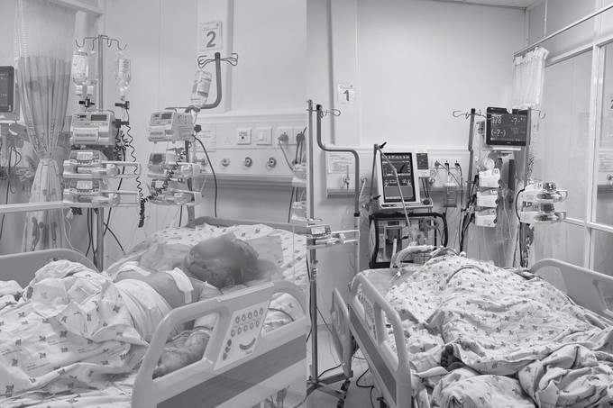 Hai cháu bé đang điều trị tại Bệnh viện Nhi đồng Thành phố/ Ảnh sggp.org.vn