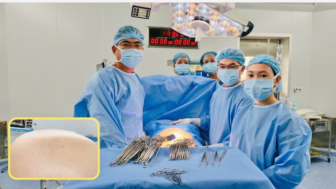 Các bác sĩ đang phẫu thuật cho bệnh nhân/Ảnh BVCC