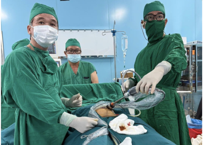 TS-BS Huỳnh Giang Châu (Bệnh viện Hùng Vương) và BS Văn Phước Toàn (Bệnh viện Bình Dân) cùng các y, bác sĩ Trung tâm Y tế Quân dân y Côn đảo phối hợp phẫu thuật nội soi cắt u quái buồng trứng cho nữ bệnh nhân ngay tại Côn Đảo vào trưa 16/9. Ảnh NLĐ
