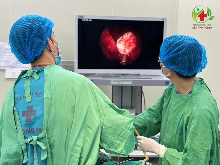 Các bác sĩ của bệnh viện đang tiến hành phẫu thuật cho bệnh nhân. Ảnh SYT Hà Nội