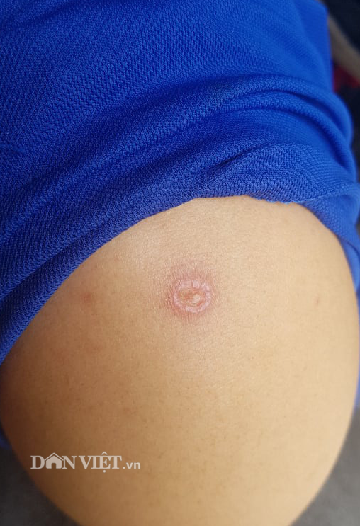 Thấy gì từ nơi đối tượng dùng súng bắn người đi đường tại tòa nhà 17T-10 nhìn ra khu vực xung quanh? - Ảnh 9.