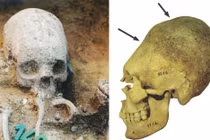 Bất ngờ lý do người La Mã cổ đại nắn dài hộp sọ cho trẻ em