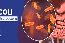 Nhiễm vi khuẩn E.coli gây biến chứng như thế nào?