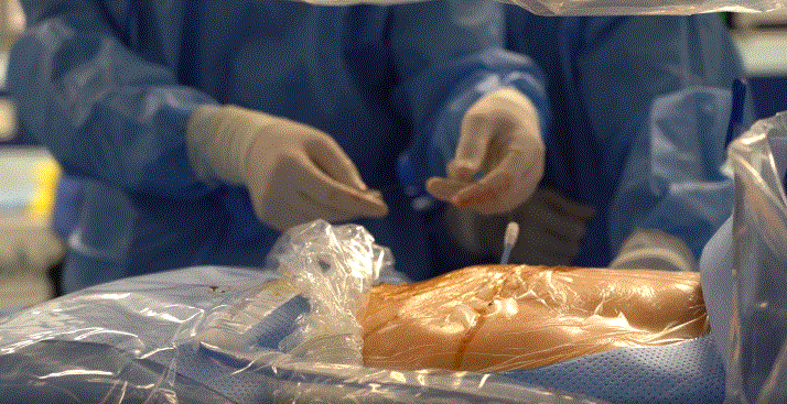 Các bác sĩ thực hiện can thiệp nhẹ nhàng với 1 vết rạch da 3mm để đưa ống nội soi và đầu tán laser.