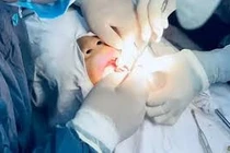 Xử phạt Công ty TNHH Nha khoa Từ Tâm Dental 44 triệu đồng