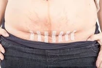 Kịp thời cứu sống hai mẹ con sản phụ thai 39 tuần nguy kịch do vỡ tử cung