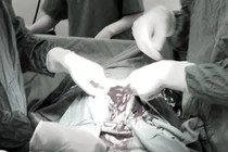 Cấp cứu thành công sản phụ bị vỡ tử cung do tự phá thai tại nhà