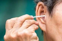 Một phụ nữ phải phẫu thuật tai do va chạm khi ngoáy tai