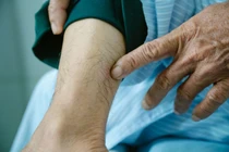 Người đàn ông ở Đà Nẵng bị kiến ba khoang đốt phải nhập viện cấp cứu