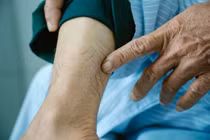 Người đàn ông ở Đà Nẵng bị kiến ba khoang đốt phải nhập viện cấp cứu