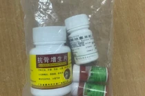 Nguy hiểm từ thuốc giảm đau trôi nổi gây suy thận cấp tính