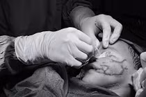 Thương tâm bé 2 tuổi bị chó cắn nham nhở khắp vùng mặt