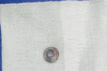 Tai nạn lao động hy hữu, người đàn ông bị rạn xương gò má