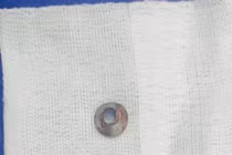 Tai nạn lao động hy hữu, người đàn ông bị rạn xương gò má