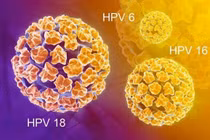 Vắc xin HPV - chìa khóa ngừa ung thư cổ tử cung hiệu quả