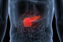 Cứu sống bệnh nhân trẻ nguy kịch nhờ lọc máu liên tục