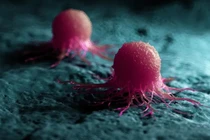 Vắc xin nano mới tiêu diệt tận gốc tế bào ung thư