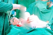 Phẫu thuật ghép sọ thành công cho bệnh nhân 15 tuổi tại Quảng Ninh