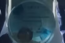 Phát minh giúp phát hiện sớm bệnh thận qua nước bồn cầu đổi màu