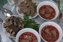 Ngứa kéo dài, đau bụng, phát hiện bệnh ký sinh trùng gan nguy hiểm