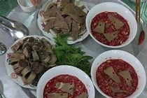 Ngứa kéo dài, đau bụng, phát hiện bệnh ký sinh trùng gan nguy hiểm