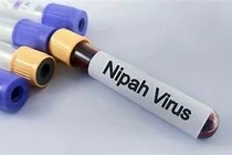 Tăng cường bảo đảm an toàn thực phẩm trong phòng, chống bệnh do virus Nipah