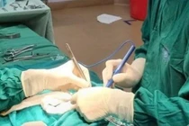 Điều trị thành công trẻ sơ sinh viêm phúc mạc do thủng ruột