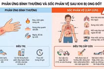 Cưu sống bệnh nhân ở Tuyên Quang sốc phản vệ do bị ong đốt 
