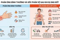 Cưu sống bệnh nhân ở Tuyên Quang sốc phản vệ do bị ong đốt 