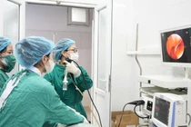 Nội soi gắp thành công dị vật hạt kha tử gây tắc đường thở nữ bệnh nhân