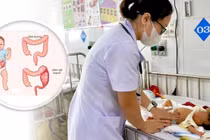 Một trẻ sơ sinh ở Nghệ An bị viêm ruột hoại tử vừa được các bắc sĩ cứu sống