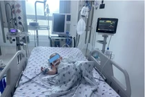 Trẻ 24 tháng mắc bệnh tay chân miệng nặng được cứu sống kịp thời