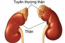 Suy tuyến thượng thận là tình trạng rối loạn trao đổi chất ở thận. Ảnh minh họa/Nguồn Internet