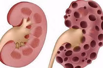 Lạm dụng thuốc giảm cân, giảm đau khiến thận tổn thương 