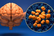 Hà Nội ghi nhận ca mắc não mô cầu là nam thanh niên 24 tuổi