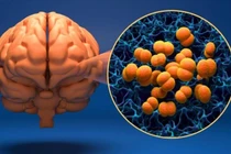 Hà Nội ghi nhận ca mắc não mô cầu là nam thanh niên 24 tuổi