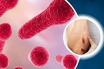 Chủ quan với vết xước nhỏ, cụ ông ở Tây Ninh suýt tử vong