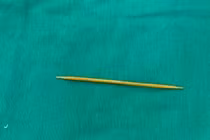 Cứu sống người phụ nữ nuốt tăm tre xuyên thủng đại tràng