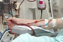 Suy thận vì dùng thực phẩm chức năng không rõ nguồn gốc