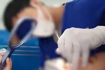 Mắc 5 vi phạm, Viện Thẩm mỹ Quốc tế Korea bị phạt 183 triệu đồng